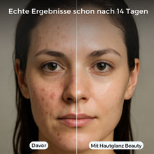 Lade das Bild in den Galerie-Viewer, Hautglanz Beauty Duschkopf - sichtbar schönere Haut